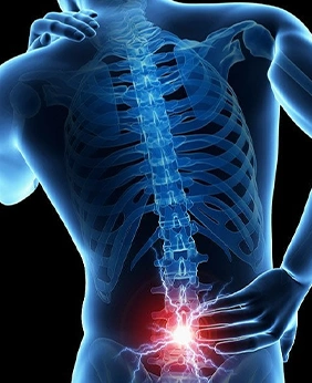 X-ray of holding lower back in pain.