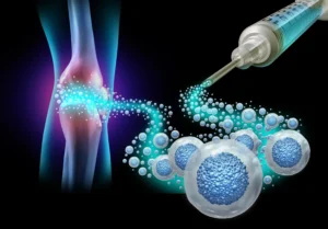 Steroid Injections to Relieve Arthritis Pain in Oklahoma City